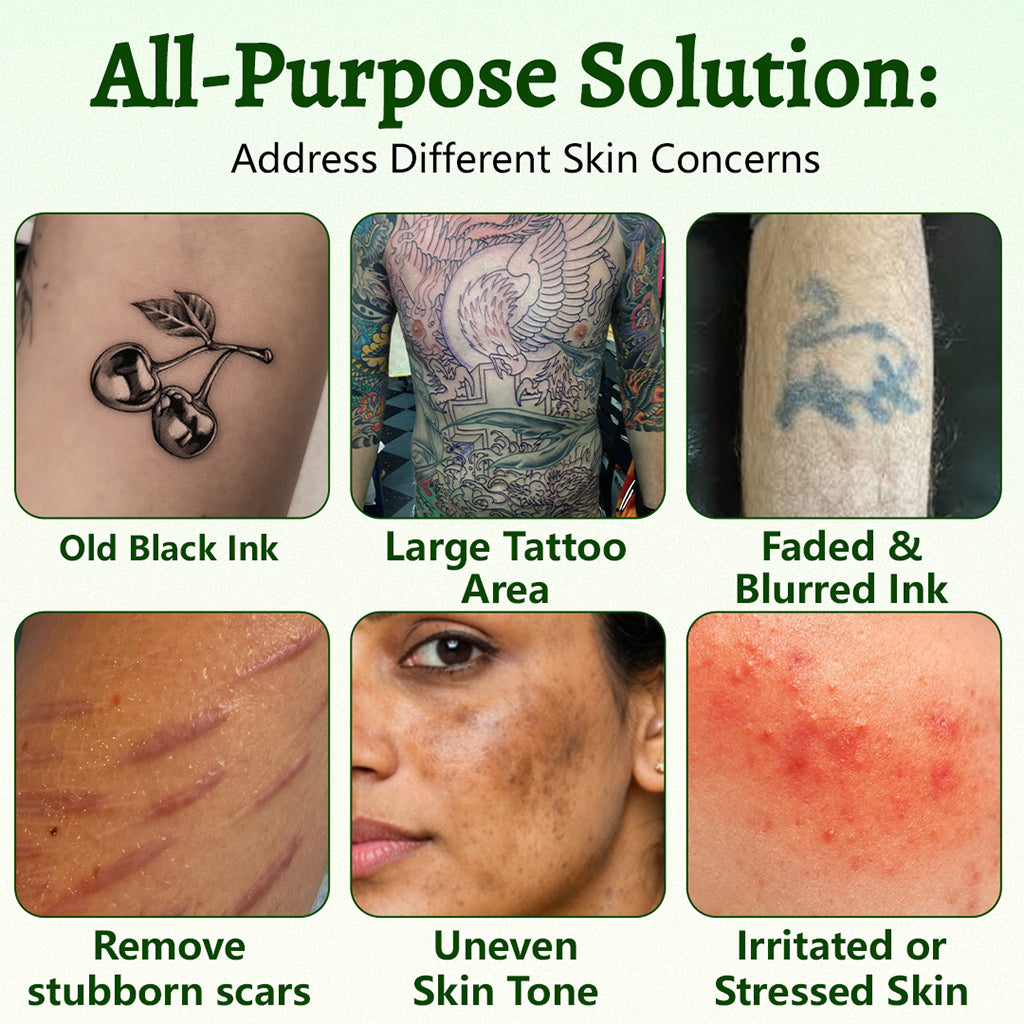 CureVivo® PureAlgae Ink Removal Support Spray 🌿 — Say Goodbye to Old Tattoo Pigment 💚, Fade Stubborn Ink ✨, Repair & Smooth Treated Skin 💧, Non-Laser ✅, Try It Now! 🔥