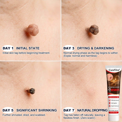 𝐎𝐟𝐟𝐢𝐜𝐢𝐚𝐥 𝐁𝐫𝐚𝐧𝐝 𝐒𝐭𝐨𝐫𝐞 |👨‍⚕️🔥𝗖𝘂𝗿𝗲𝗩𝗶𝘃𝗼® Scorpion Skin Care Cream | Advanced Skin Smoothing Treatment for Spots & Uneven Skin Appearance