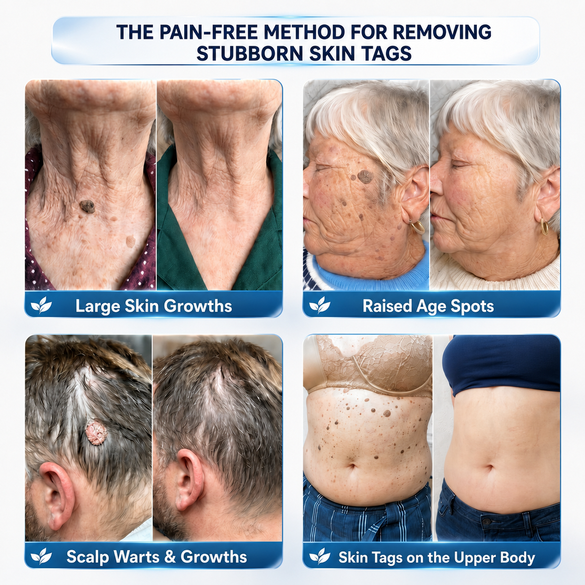 🚀🚀𝗖𝘂𝗿𝗲𝗩𝗶𝘃𝗼® 𝟕-𝐃𝐚𝐲 𝐒𝐤𝐢𝐧 𝐓𝐚𝐠 & 𝐒𝐩𝐨𝐭 𝐑𝐞𝐦𝐨𝐯𝐚𝐥 𝐂𝐫𝐞𝐚𝐦 (𝐏𝐚𝐢𝐧𝐥𝐞𝐬𝐬 𝐅𝐨𝐫𝐦𝐮𝐥𝐚 – 𝐍𝐨 𝐒𝐜𝐚𝐫𝐬)