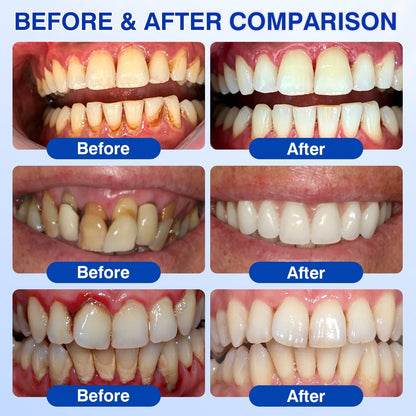 🇺🇸👨‍⚕️🦷 CureVivo® GumRevive Periodontal Repair Gel⏰⏰
