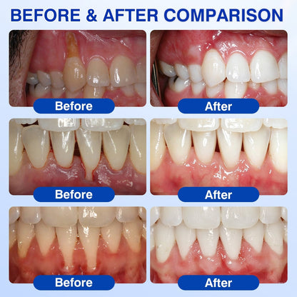 🇺🇸👨‍⚕️🦷 CureVivo® GumRevive Periodontal Repair Gel⏰⏰