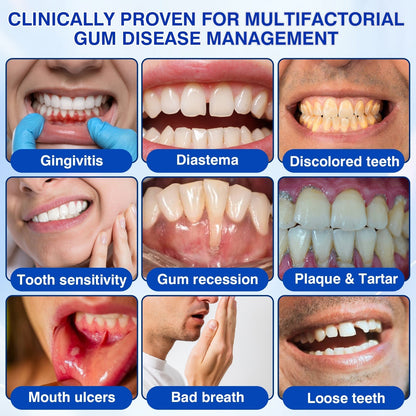 🇺🇸👨‍⚕️🦷 CureVivo® GumRevive Periodontal Repair Gel⏰⏰
