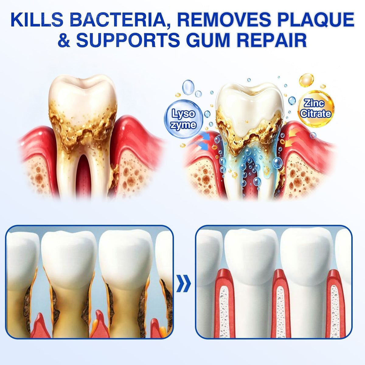 🇺🇸👨‍⚕️🦷 CureVivo® GumRevive Periodontal Repair Gel⏰⏰