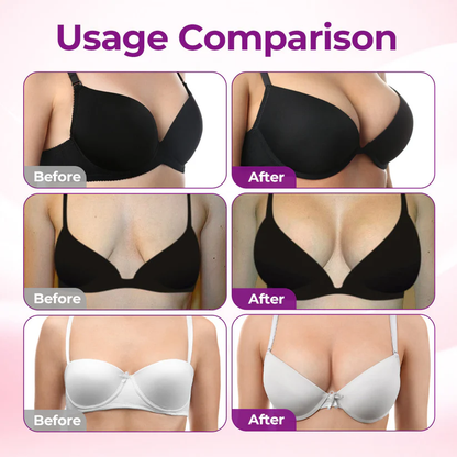 🍇Turonu® 🦪Targeted Breast Enhancement Advanced Nano Microneedle Patch💃