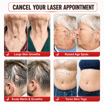𝐎𝐟𝐟𝐢𝐜𝐢𝐚𝐥 𝐁𝐫𝐚𝐧𝐝 𝐒𝐭𝐨𝐫𝐞 |👨‍⚕️🔥𝗖𝘂𝗿𝗲𝗩𝗶𝘃𝗼® Scorpion Skin Care Cream | Advanced Skin Smoothing Treatment for Spots & Uneven Skin Appearance