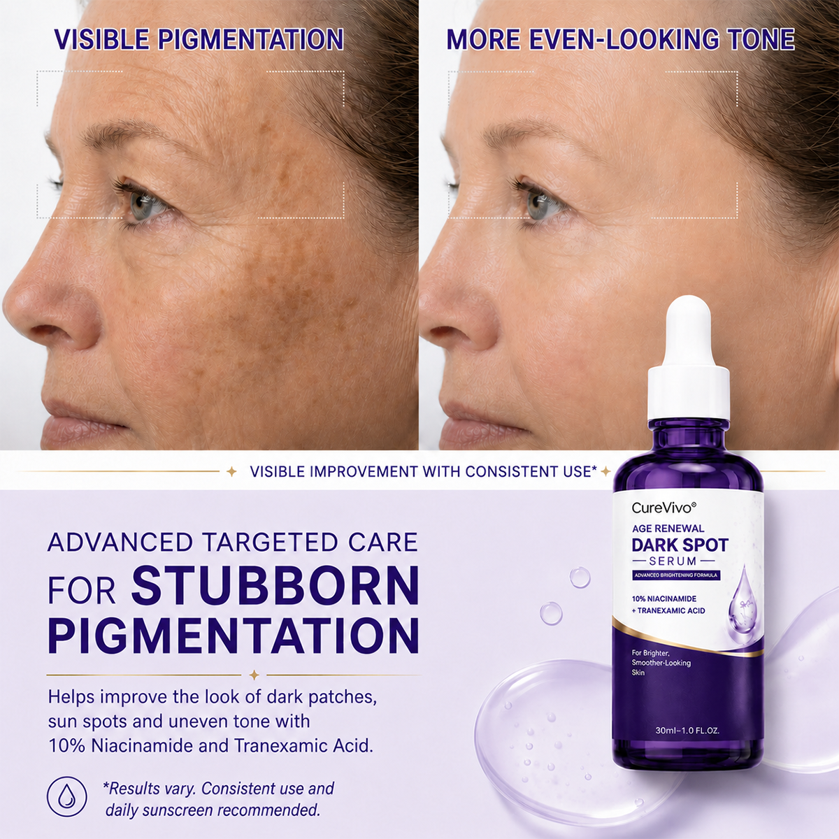 🐬CureVivo® Advanced Targeted Serum for Stubborn Pigmentation