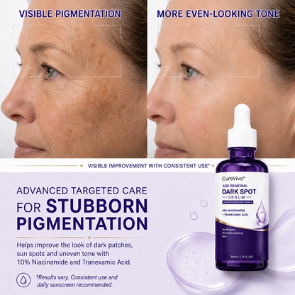 🐬CureVivo® Advanced Targeted Serum for Stubborn Pigmentation