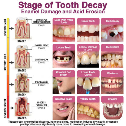🇺🇸🦷👩‍⚕️CureViVo® DenPerm Cavity-Repair Natural Enamel Filling Gel👍