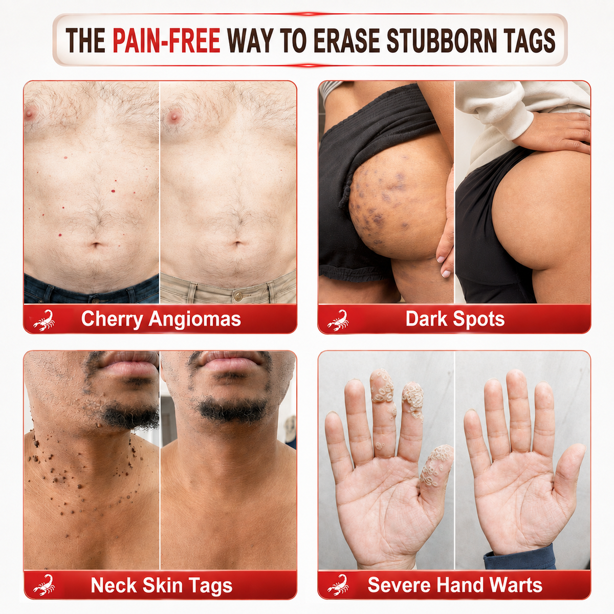 𝐎𝐟𝐟𝐢𝐜𝐢𝐚𝐥 𝐁𝐫𝐚𝐧𝐝 𝐒𝐭𝐨𝐫𝐞 |👨‍⚕️🔥𝗖𝘂𝗿𝗲𝗩𝗶𝘃𝗼® Scorpion Skin Care Cream | Advanced Skin Smoothing Treatment for Spots & Uneven Skin Appearance