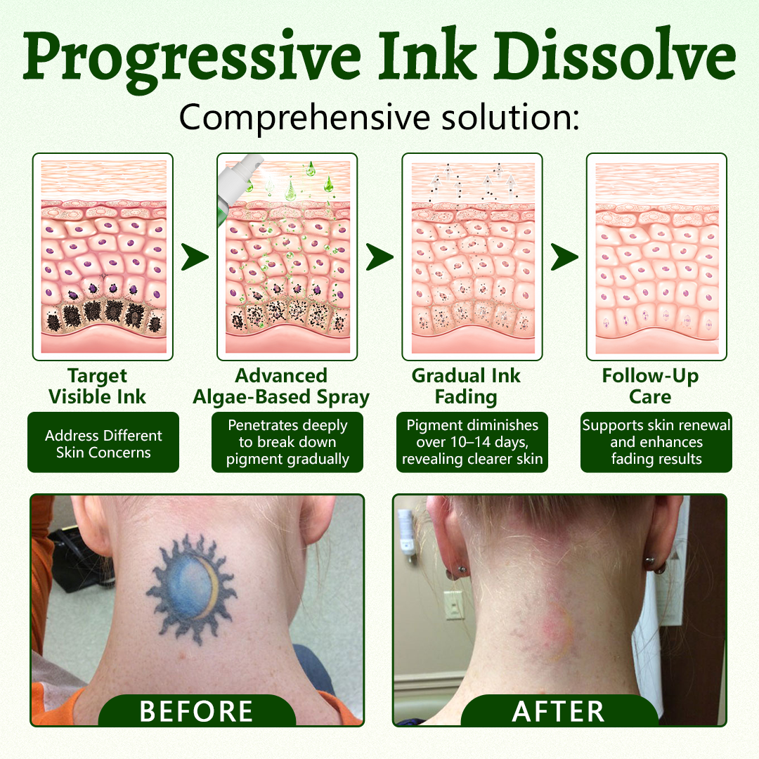 CureVivo® PureAlgae Ink Removal Support Spray 🌿 — Say Goodbye to Old Tattoo Pigment 💚, Fade Stubborn Ink ✨, Repair & Smooth Treated Skin 💧, Non-Laser ✅, Try It Now! 🔥