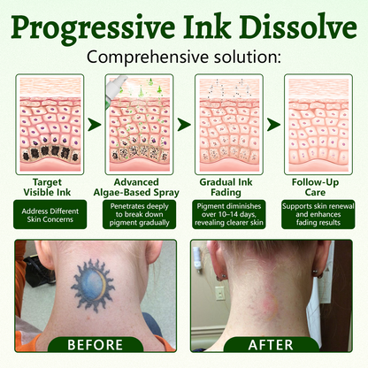 CureVivo® PureAlgae Ink Removal Support Spray 🌿 — Say Goodbye to Old Tattoo Pigment 💚, Fade Stubborn Ink ✨, Repair & Smooth Treated Skin 💧, Non-Laser ✅, Try It Now! 🔥