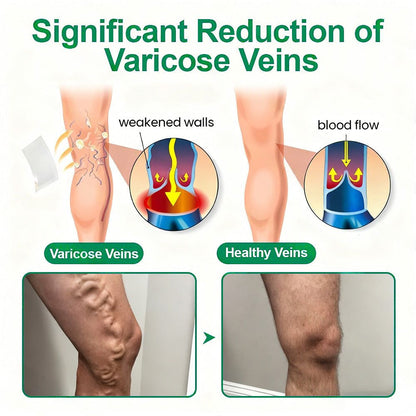 🗽👩‍⚕️👍Healrize® VeinTarget Microneedle Patch⚡Instant Relief, Long-Term Results