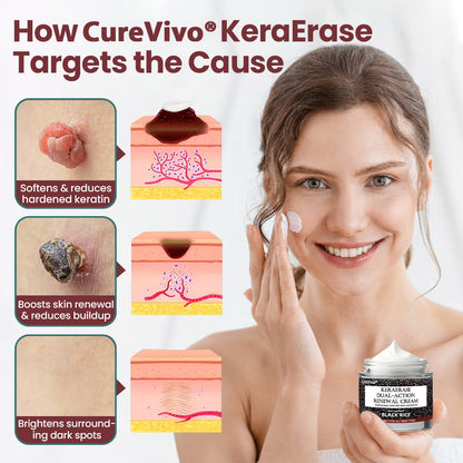 CureVivo® KeraErase Dual-Action Renewal Cream🚀