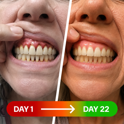 REBYIPO® GumRevive Advanced Dual-Wavelength Gum Care System