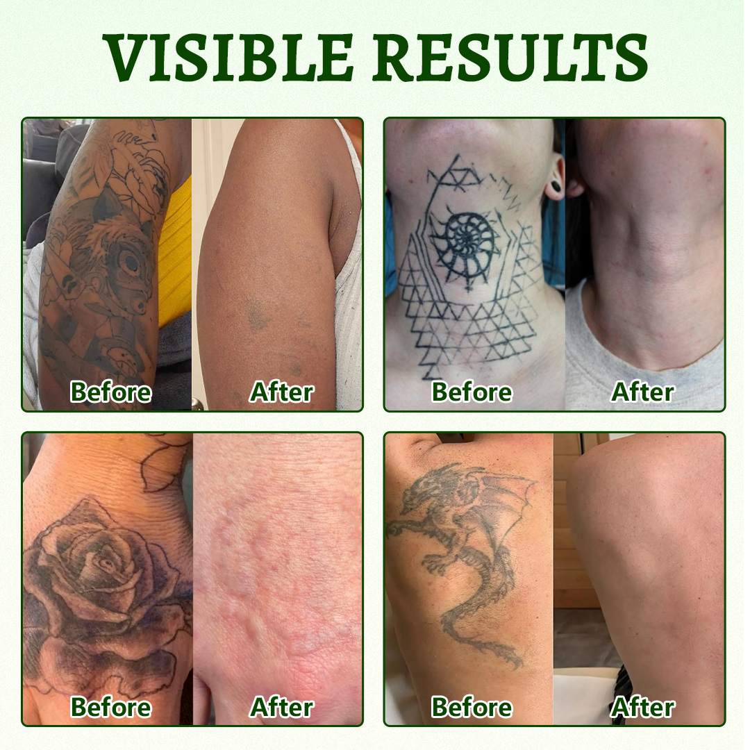 CureVivo® PureAlgae Ink Removal Support Spray 🌿 — Say Goodbye to Old Tattoo Pigment 💚, Fade Stubborn Ink ✨, Repair & Smooth Treated Skin 💧, Non-Laser ✅, Try It Now! 🔥
