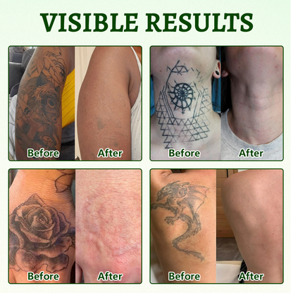 CureVivo® PureAlgae Ink Removal Support Spray 🌿 — Say Goodbye to Old Tattoo Pigment 💚, Fade Stubborn Ink ✨, Repair & Smooth Treated Skin 💧, Non-Laser ✅, Try It Now! 🔥