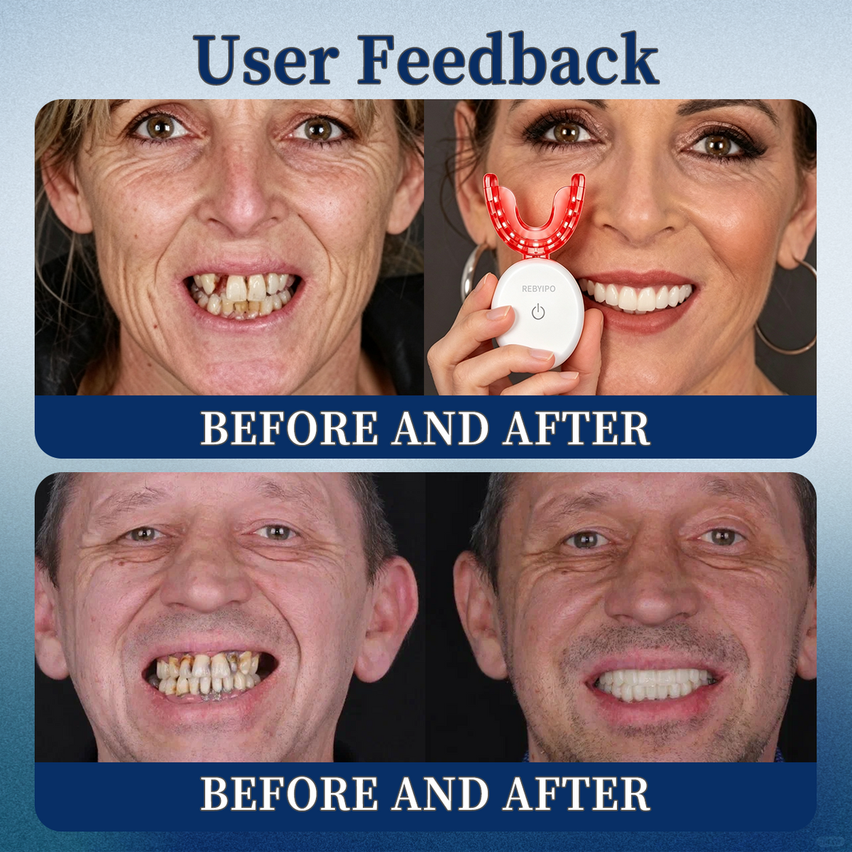 REBYIPO® GumRevive Advanced Dual-Wavelength Gum Care System