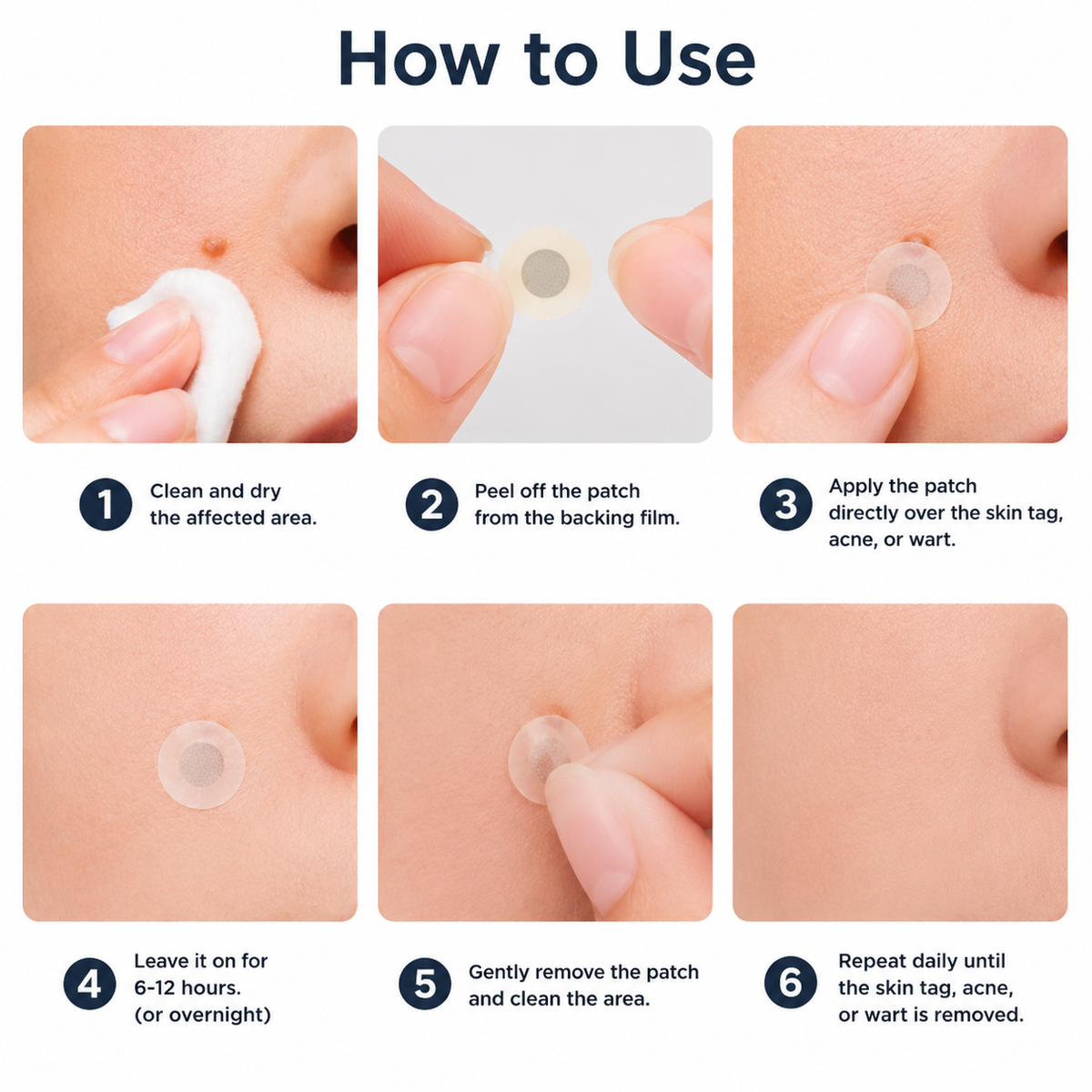 🇺🇸✅𝐇𝐞𝒂𝒍𝗿𝗶𝙯𝙚®2-in-1 Microneedle & Hydrocolloid Patch🔥| Removes Raised Moles, Acne, Flat Warts & Skin Tags | Helps Improve Wrinkles, Scars & Blemishes | Invisible Patches for Face & Body