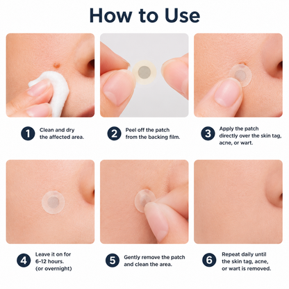 🇺🇸✅𝐇𝐞𝒂𝒍𝗿𝗶𝙯𝙚®2-in-1 Microneedle & Hydrocolloid Patch🔥| Removes Raised Moles, Acne, Flat Warts & Skin Tags | Helps Improve Wrinkles, Scars & Blemishes | Invisible Patches for Face & Body