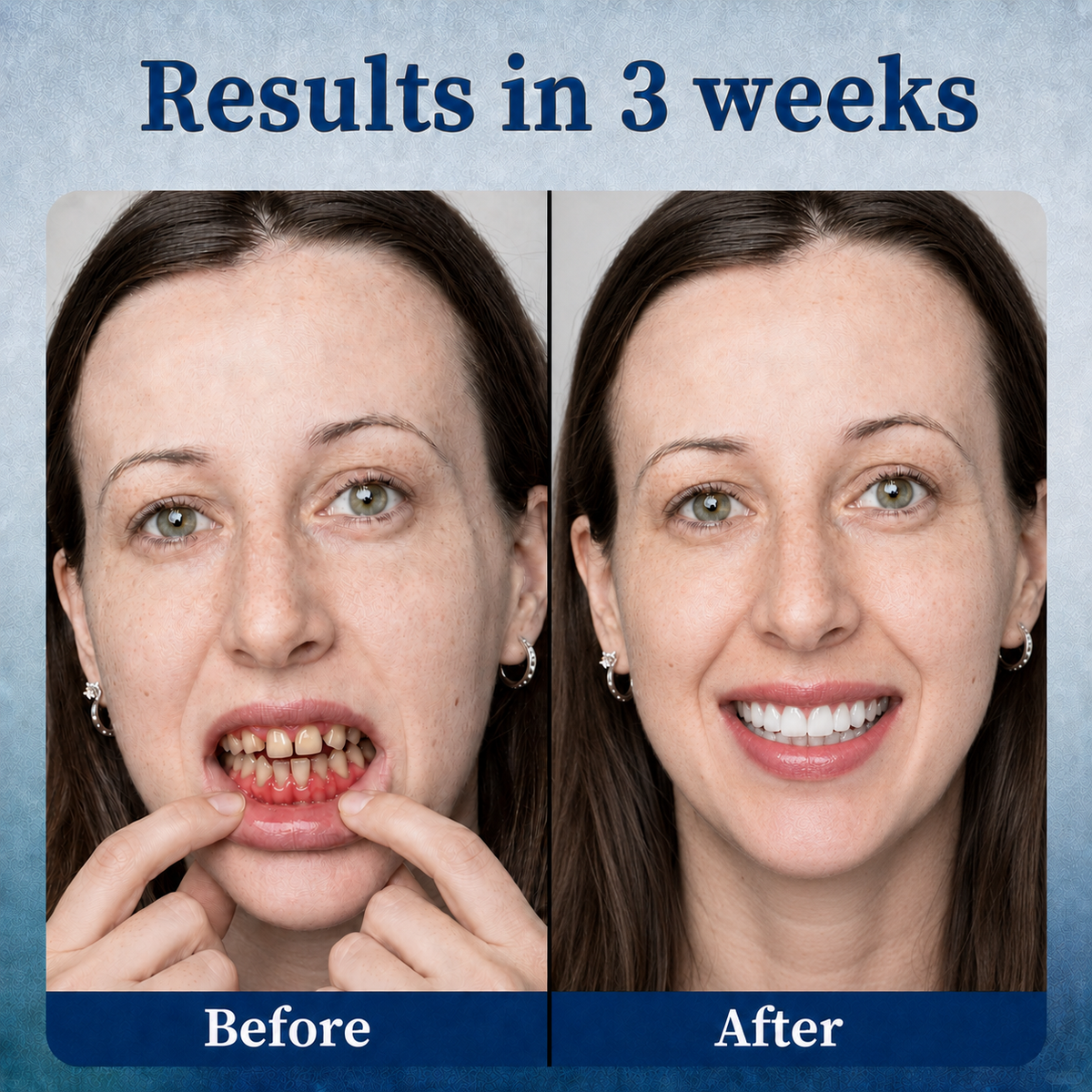 REBYIPO® GumRevive Advanced Dual-Wavelength Gum Care System