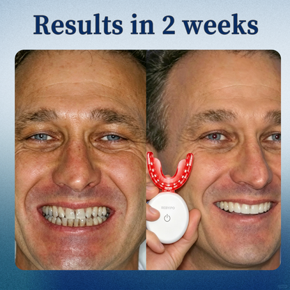 REBYIPO® GumRevive Advanced Dual-Wavelength Gum Care System