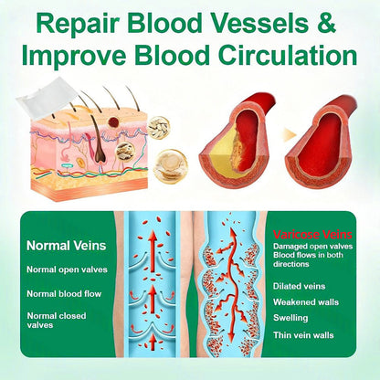 🗽👩‍⚕️👍Healrize® VeinTarget Microneedle Patch⚡Instant Relief, Long-Term Results